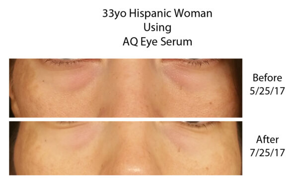 AQ Eye Serum noorendav silmaümbruse seerum, 15 ml