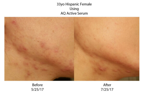 Noorendav näoseerum AQ Active Serum , 30 ml